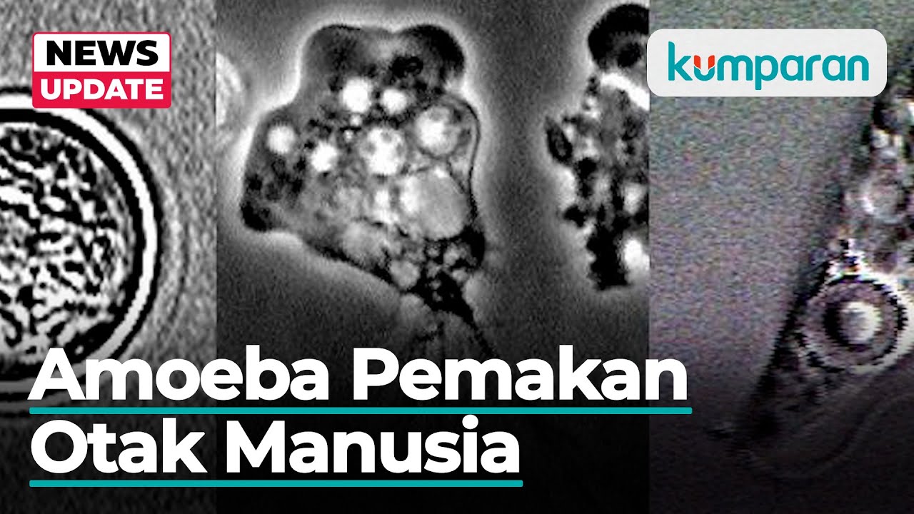 Dialami Bocah 9 Tahun, Kenapa Infeksi Amoeba Pemakan Otak Bisa Picu Kematian?