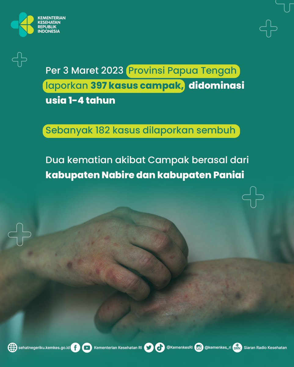 Kasus Kematian Akibat Campak, Kementerian Kesehatan Ingatkan Pentingnya Imunisasi!