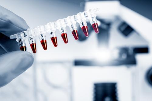 Stem Cell Populer, Efektifkah Obati Penyakit Kronis?