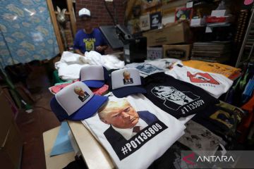Tangan Donald Trump Ramai Disorot gegara Lebam, Begini Kondisinya
