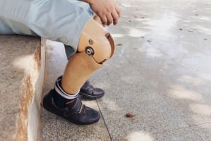 Ternyata Pasien Amputasi Masih Bisa Rasakan Anggota Tubuh yang Hilang