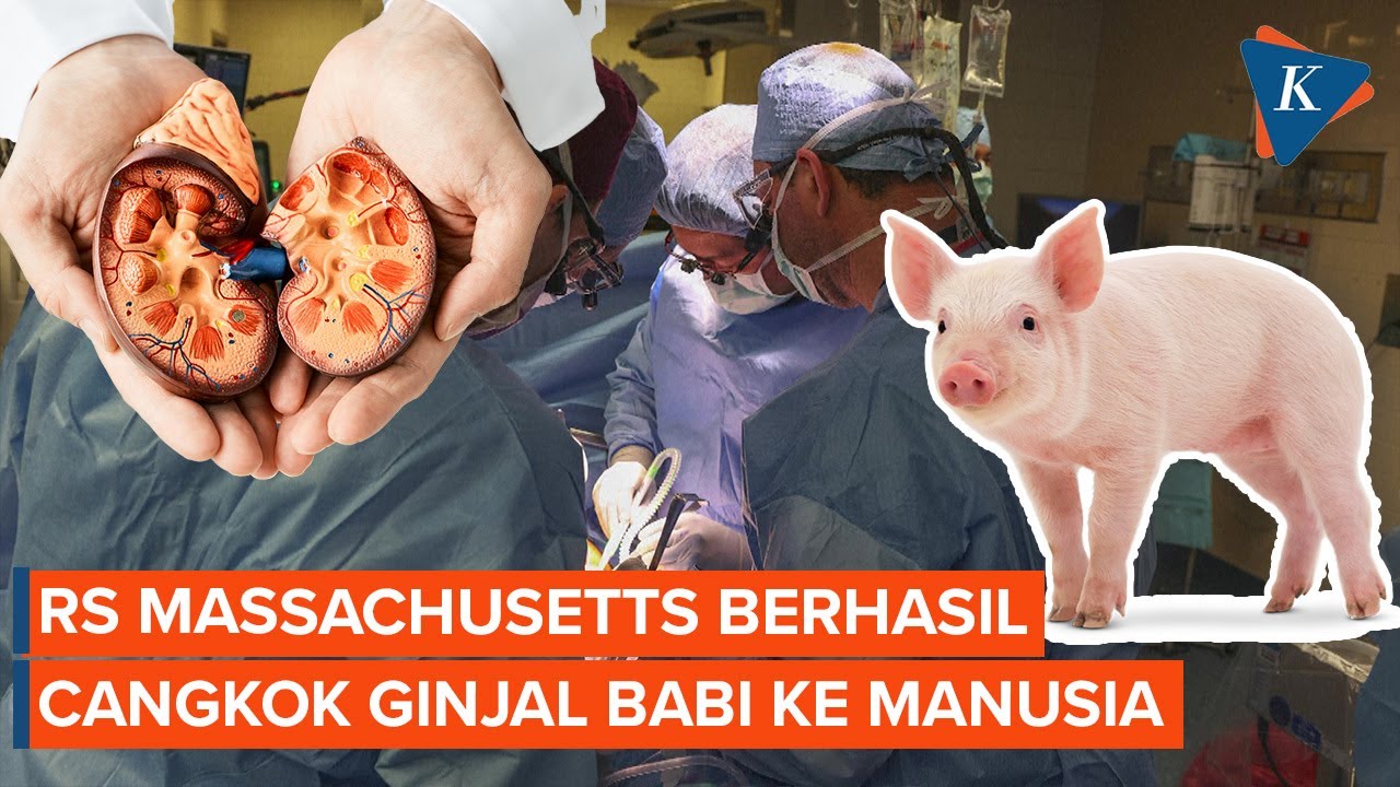 Awal Mula Pasien di AS Jalani Transplantasi Ginjal Babi, Punya Riwayat Gagal Ginjal