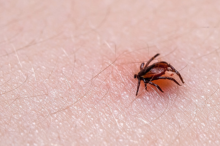 Bella Hadid Terbaring di RS, Idap Penyakit Lyme Disease Sejak Umur 16 Tahun