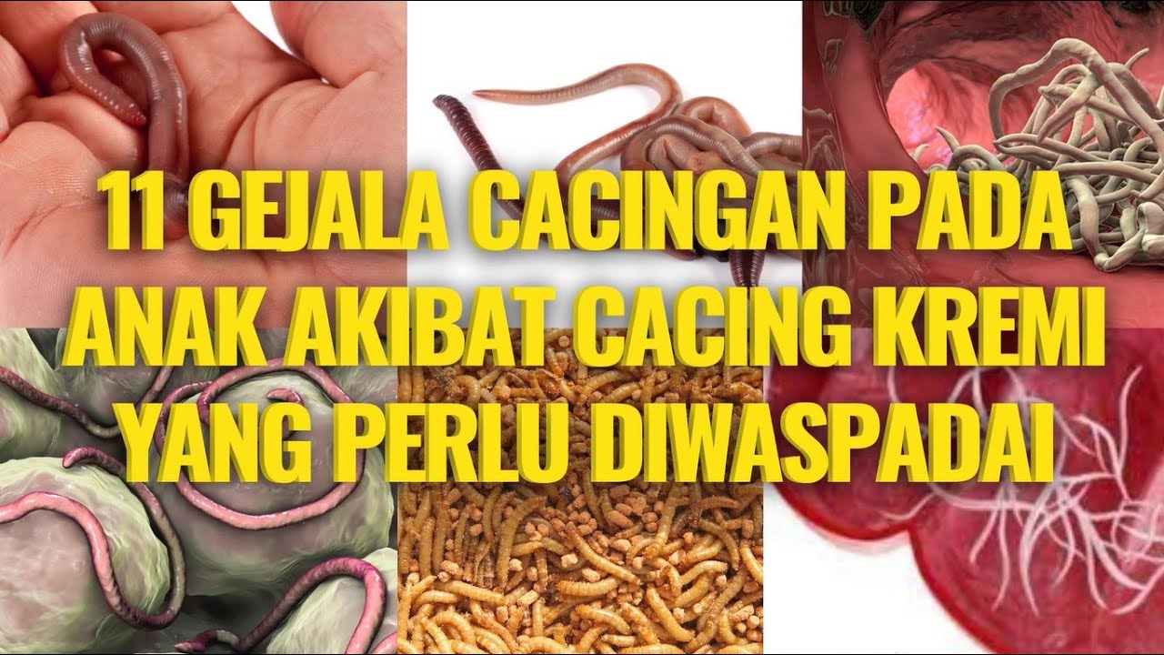 BKKBN Respons Kasus Viral Balita Muntah Cacing, Ada Larva di Paru-paru.