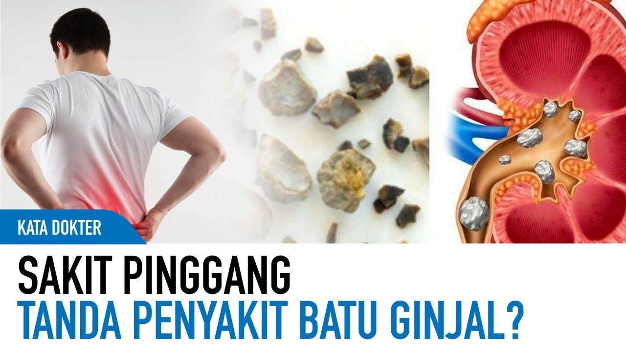 Ciri-ciri Sakit Punggung yang Menandakan Idap Batu Ginjal, Waspada!