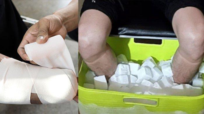 Dokter Bedah Amputasi Kakinya demi Fetish, Dipenjara karena Penipuan Asuransi.