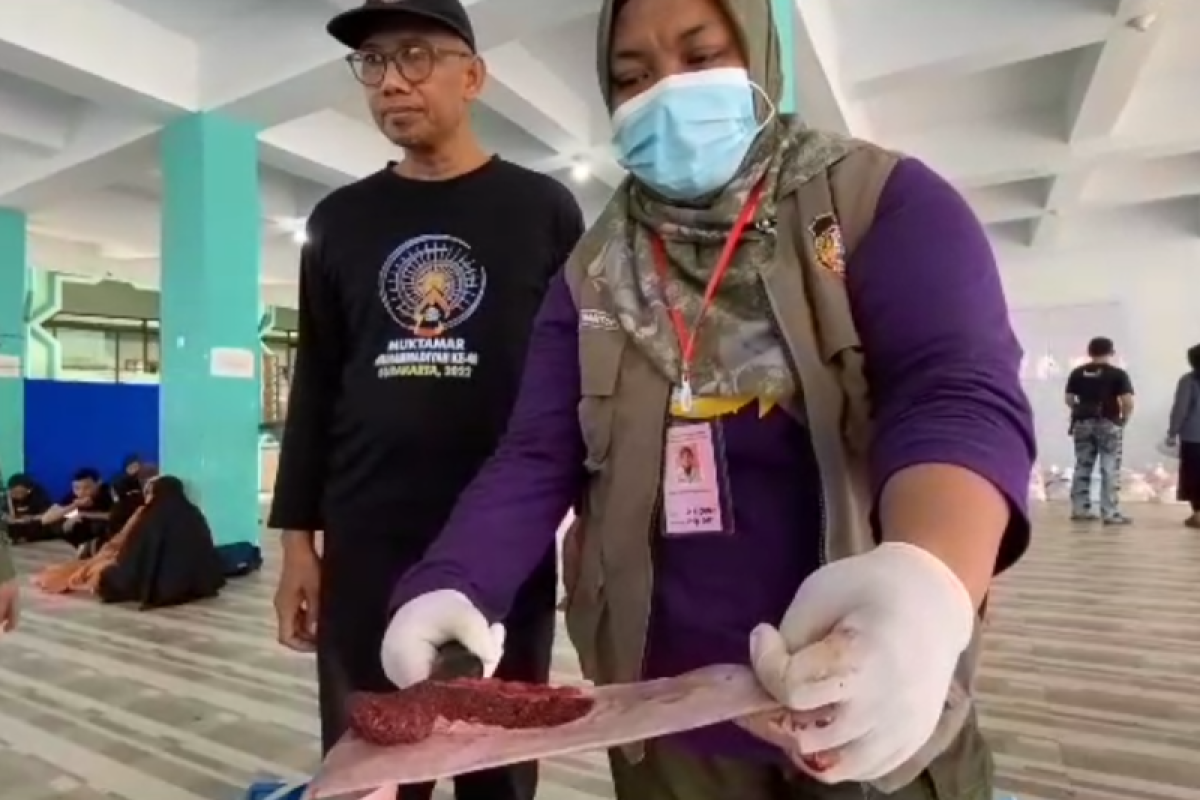 Dokter Temukan Cacing Hidup di Otak Pria, Penyebabnya Tak Disangka-sangka