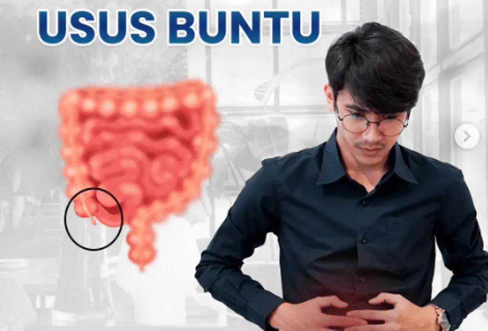 Kisah Dokter Bedah Lakukan Operasi Usus Buntu ke Dirinya Sendiri