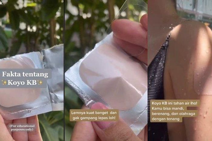 Mengenal KB Koyo, Begini Cara Pakai dan Efek Sampingnya : Okezone Women