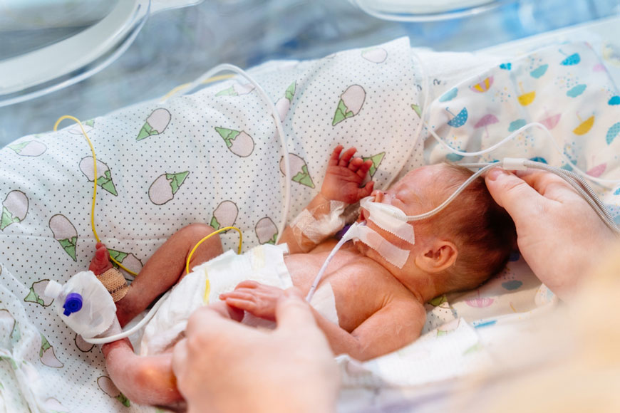 Risiko Kehamilan di Usia Kepala 4, Bayi Bisa Lahir Prematur.
