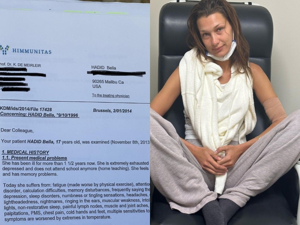 Supermodel Bella Hadid Bagikan Foto Dirawat di RS, Sakit Apa?