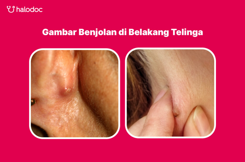 Tercium Bau dari Belakang Telinga? Ini Penyebab dan Cara Mengatasinya