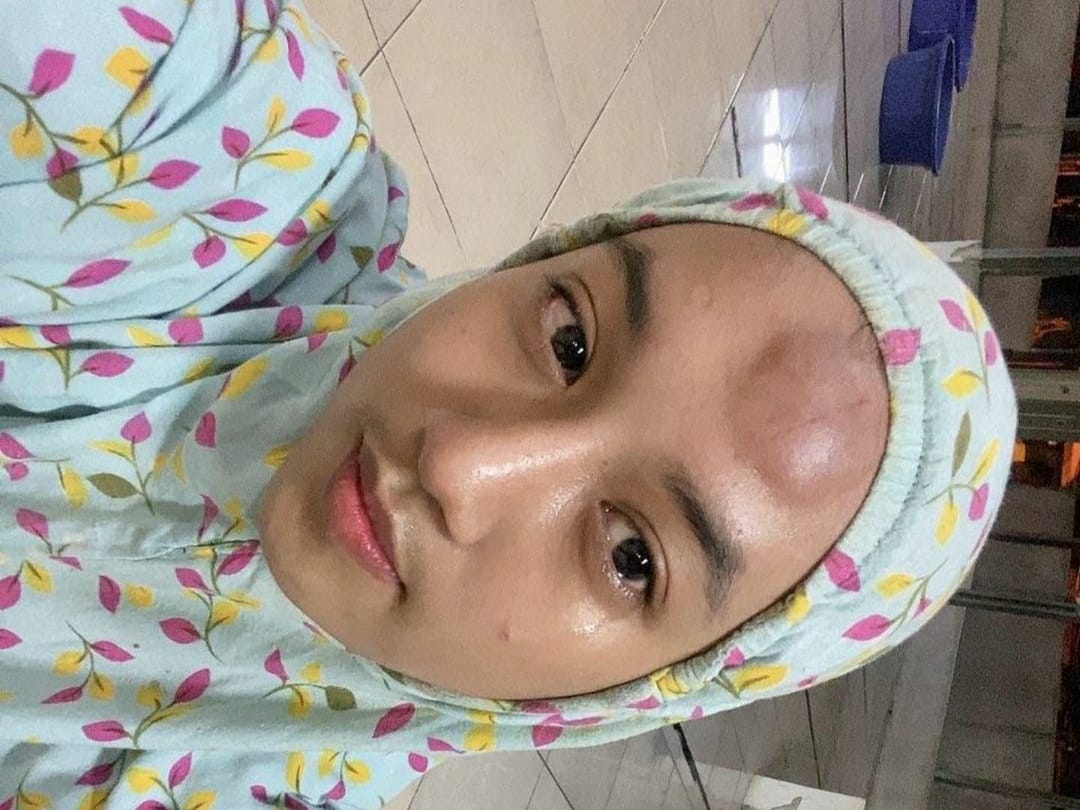 Terpeleset Saat Selfie, Wanita Ini Jatuh 90 Meter dan Meninggal