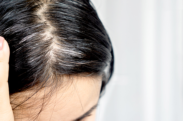 Viral Tren Suntik 'Obat Uban' di China, Rambut Putih Diklaim Bisa Kembali Hitam